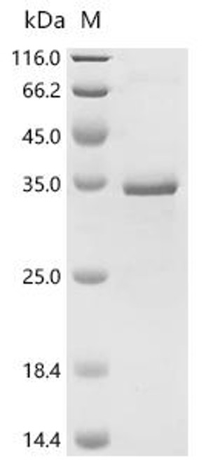 Recombinant Mouse Transcription intermediary factor 1-beta (Trim28), partial (CSB-EP717259MO)