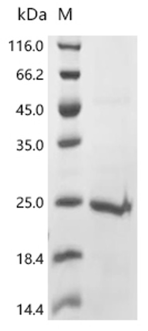 Recombinant Human Protein tweety homolog 1 (TTYH1), partial (CSB-EP867139HU1)