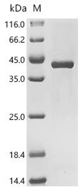 Recombinant Mouse Thymidylate synthase (Tyms) (CSB-EP025393MO)