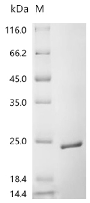 Recombinant Mouse Versican core protein (Vcan), partial (CSB-EP720284MOc7)