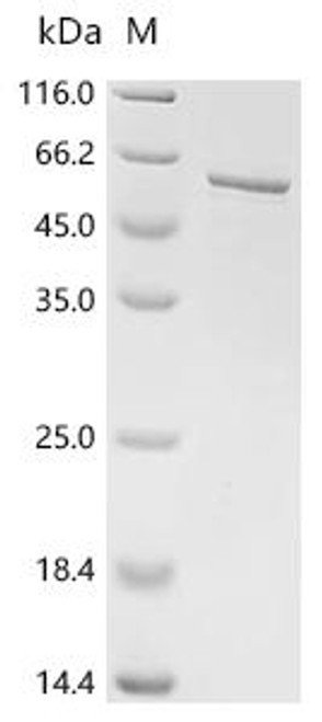Recombinant Human tRNA (guanine-N(7)-)-methyltransferase non-catalytic subunit WDR4 (WDR4) (CSB-EP026021HU)