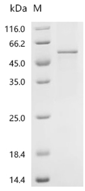 Recombinant Human Protein Wnt-10a (WNT10A) (CSB-EP884424HU)