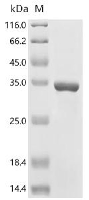 Recombinant Escherichia coli Probable autotransporter YpjA (ypjA), partial (CSB-EP345175ENV)