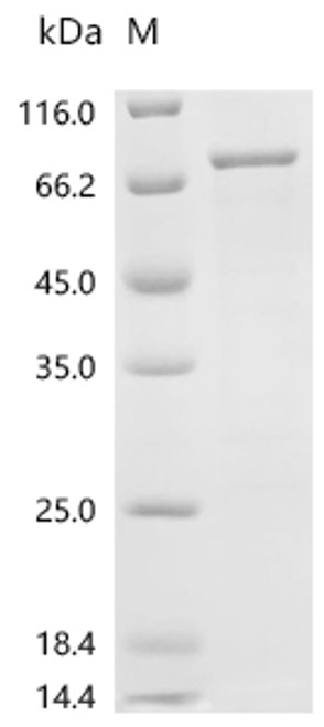 Recombinant Human YTH domain-containing family protein 1 (YTHDF1) (CSB-EP874843HUc7)