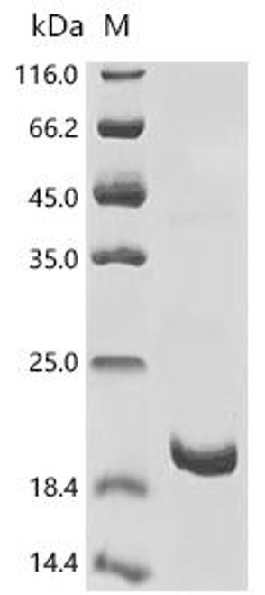 Recombinant Atrax robustus Delta-hexatoxin-Ar1a (CSB-EP355657AVG)