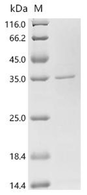 Recombinant Tachypleus tridentatus clotting factor C, partial (CSB-EP335355TAHa0)