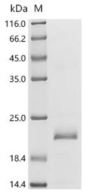 Recombinant Naja atra Acidic phospholipase A2 2 (CSB-EP838600NFG)