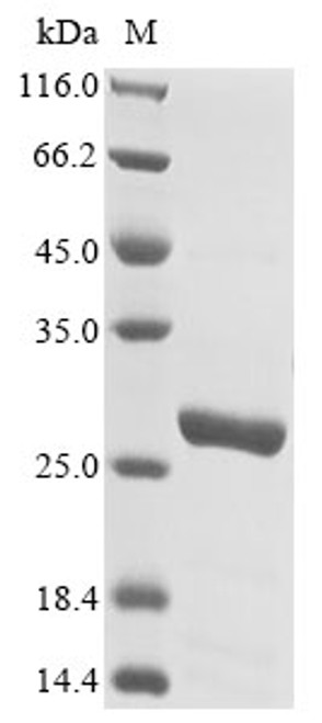 Recombinant Schistosoma japonicum Glutathione S-transferase class-mu 26 kDa isozyme (CSB-EP357414SXP)