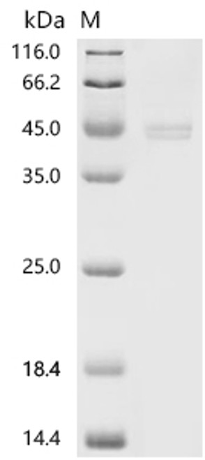 Recombinant Human Interferon-induced, double-stranded RNA-activated protein kinase (EIF2AK2), partial (CSB-BP007511HU)