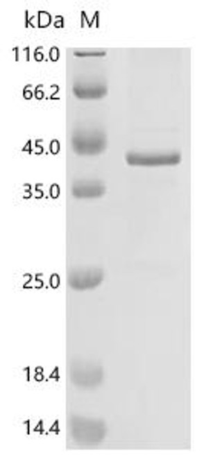 Recombinant Human Pendrin (SLC26A4), partial (CSB-BP021527HU2)