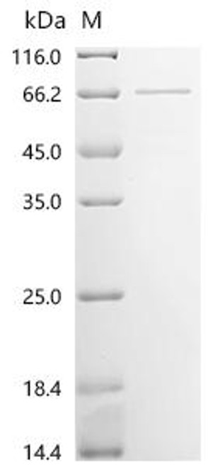 Recombinant Dog Werner syndrome ATP-dependent helicase isoform X2, partial (CSB-BP5942DO)