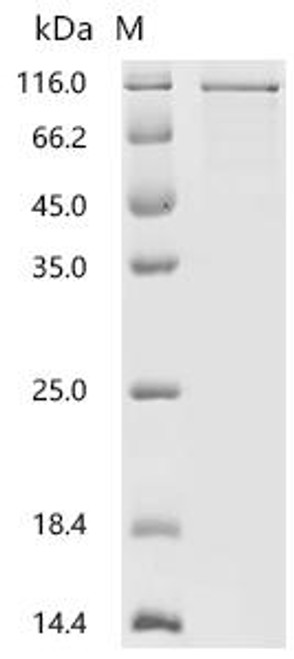 Recombinant Human Neurogenin-2 (NEUROG2) (CSB-MP887960HU)