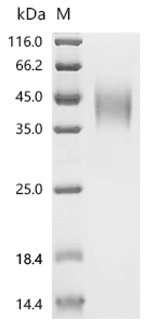 Recombinant Human Signal transducer CD24 (CD24), partial-Nanoparticle (CSB-MP004902HUb0)