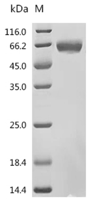 Recombinant Human Inactive tyrosine-protein kinase transmembrane receptor ROR1 (ROR1), partial, Biotinylated (CSB-MP020067HU1k7-B)