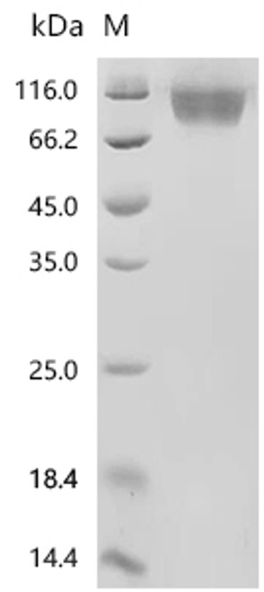 Recombinant Human immunodeficiency virus 1 Envelope glycoprotein gp160 (env), partial (Active) (CSB-MP6761GJP)