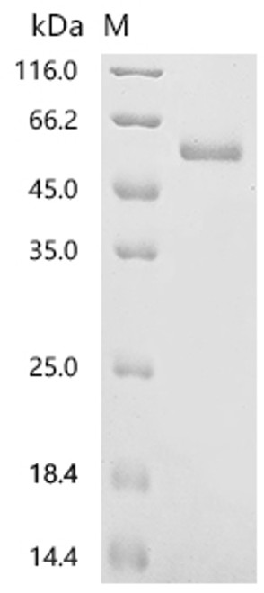 Recombinant Human Ephrin-A5 (EFNA5), partial (CSB-MP007464HU1)