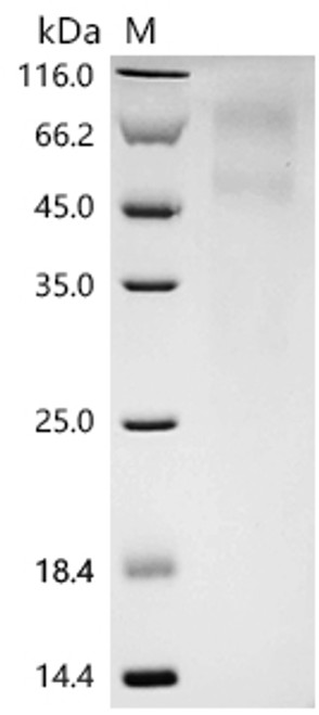 Recombinant Mouse Protein RD3 (Rd3) (CSB-MP805945MO)