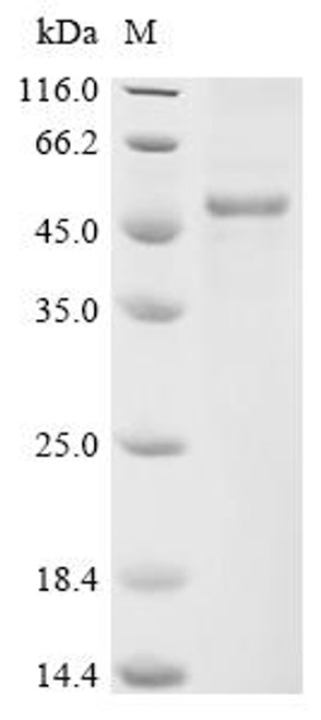 Recombinant Human Sodium channel protein type 1 subunit alpha (SCN1A), partial (CSB-MP020834HU)
