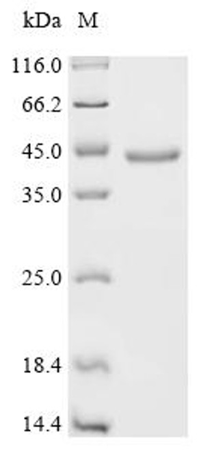 Recombinant Sendai virus Fusion glycoprotein F0 (F), partial (CSB-MP361388SFB)