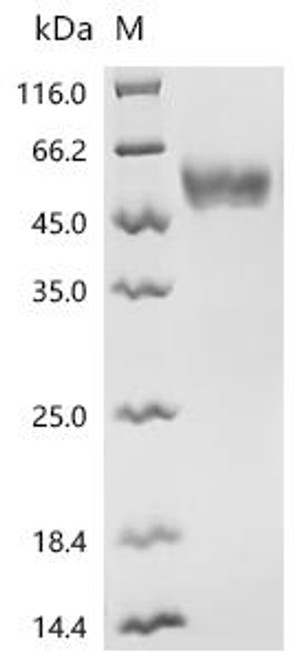 Recombinant Human Neutral amino acid transporter 9 (SLC38A9), partial (CSB-MP836713HU)