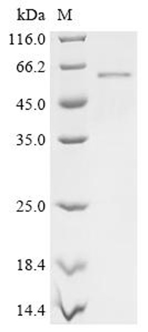 Recombinant Human Melanoma-associated antigen 2 (MAGEA2; MAGEA2B) (CSB-MP013327HU)