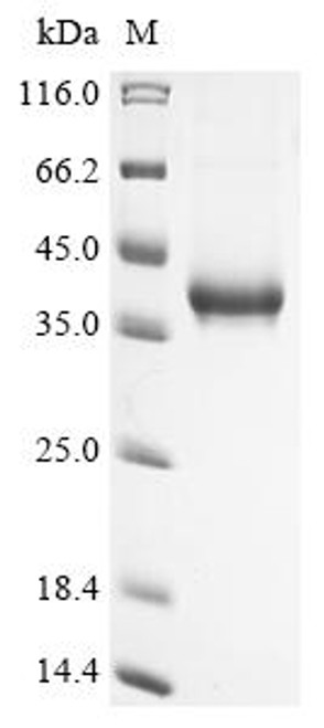 Recombinant Vaccinia virus Protein OPG190 (OPG190), partial (CSB-MP312446VAI)