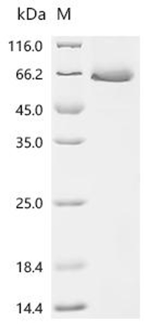 Recombinant Human TSH alpha/beta Heterodimer Protein (CSB-MP5167HU)
