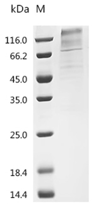 Recombinant Human Somatostatin receptor type 2 (SSTR2)-Detergent (CSB-MP022725HU-D)