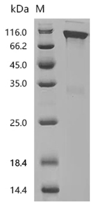 Recombinant Mouse Macrophage colony-stimulating factor 1 receptor (Csf1r), partial (Active) (CSB-MP006044MO)