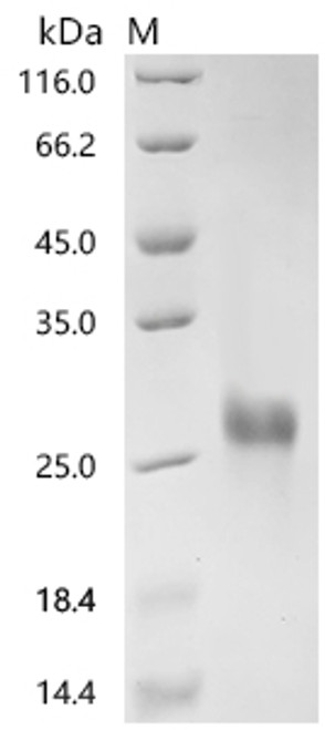 Recombinant Human T-cell surface glycoprotein CD8 alpha chain (CD8A), partial (Active) (CSB-MP004966HUd7)