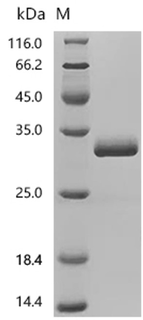 Recombinant Human Chromogranin-A (CHGA), partial (CSB-MP005344HU2)