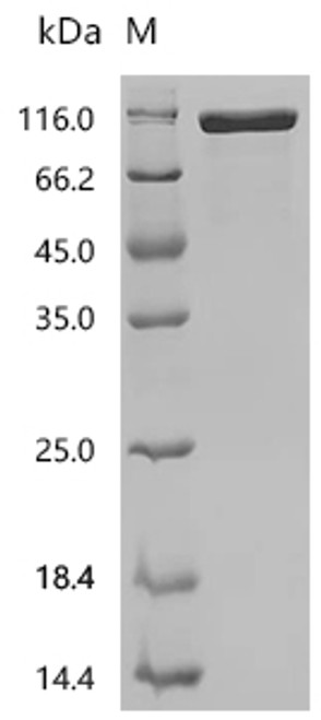 Recombinant Human Neural cell adhesion molecule 1 (NCAM1), partial (Active) (CSB-MP015511HU2)
