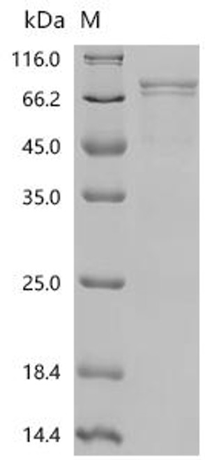 Recombinant Human Long-chain-fatty-acid--CoA ligase 1 (ACSL1)-Detergent (CSB-MP001191HUq3-D)