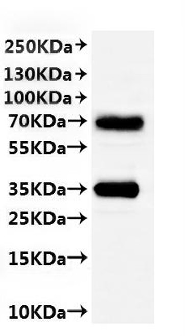 Recombinant Mouse Membrane protein MLC1 (Mlc1)-VLPs (CSB-MP837739MO(A4))