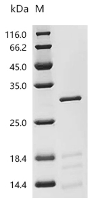 Recombinant Mouse Urokinase-type plasminogen activator(Plau) (CSB-MP018121MO)
