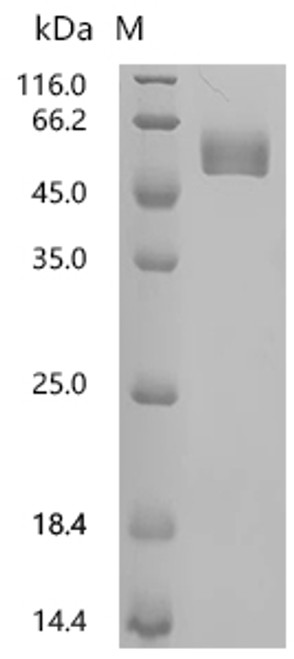 Recombinant Mouse T-cell surface glycoprotein CD4 (Cd4), partial (CSB-MP004935MO1)