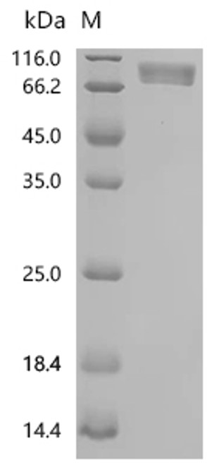 Recombinant Human Platelet-derived growth factor receptor alpha (PDGFRA), partial (Active) (CSB-MP017712HU1)