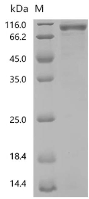 Recombinant Human Interleukin-3 receptor subunit alpha (IL3RA), partial (CSB-MP011658HU1)