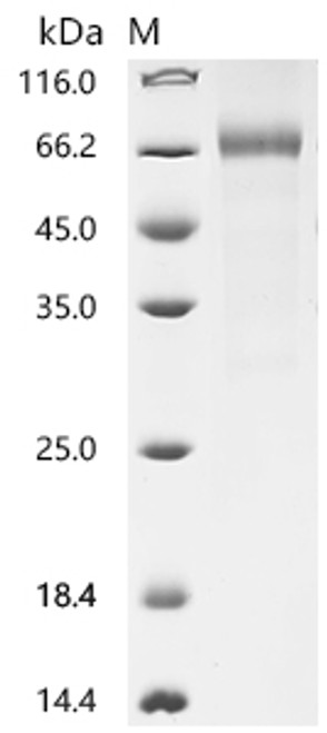 Recombinant Human Cytokine receptor-like factor 2 (CRLF2), partial (CSB-MP005983HUd9) Recombinant Human Cytokine receptor-like factor 2 (CRLF2), partial (CSB-MP005983HUd9)