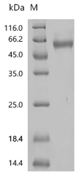 Recombinant Human GTPase NRas (NRAS) (CSB-MP016070HUk6) Recombinant Human GTPase NRas (NRAS) (CSB-MP016070HUk6)