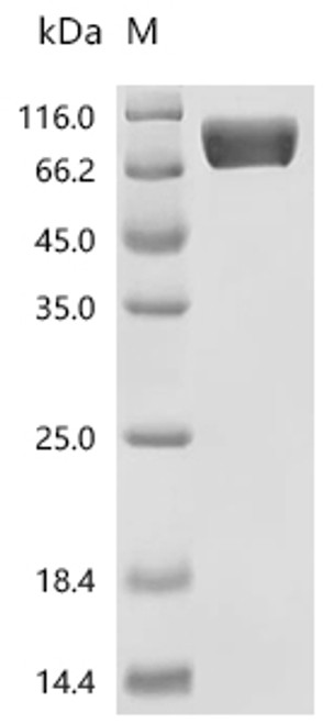 Recombinant Mouse Mast/stem cell growth factor receptor Kit (Kit), partial (CSB-MP012375MO1) Recombinant Mouse Mast/stem cell growth factor receptor Kit (Kit), partial (CSB-MP012375MO1)