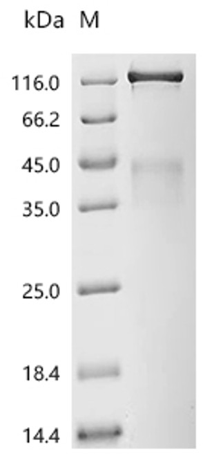 Recombinant Human Insulin receptor (INSR), partial (Active) (CSB-MP011753HU) Recombinant Human Insulin receptor (INSR), partial (Active) (CSB-MP011753HU)