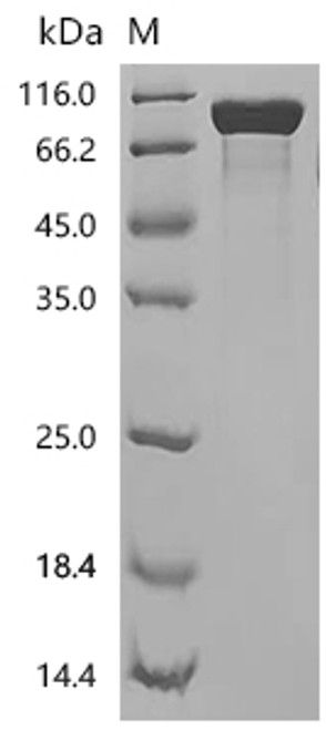 Recombinant Human Granulocyte colony-stimulating factor receptor (CSF3R), partial (CSB-MP860321HU3) Recombinant Human Granulocyte colony-stimulating factor receptor (CSF3R), partial (CSB-MP860321HU3)