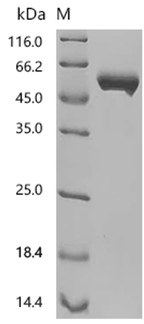 Recombinant Human Tyrosine-protein kinase transmembrane receptor ROR2 (ROR2), partial (CSB-MP932279HU) Recombinant Human Tyrosine-protein kinase transmembrane receptor ROR2 (ROR2), partial (CSB-MP932279HU)