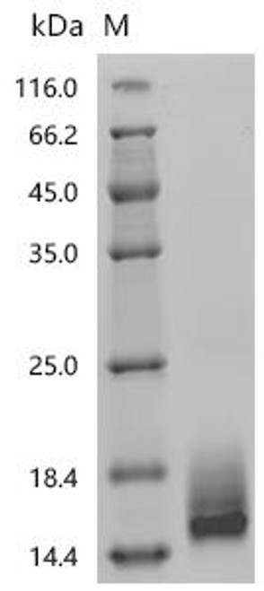 Recombinant Human Seizure protein 6 homolog (SEZ6), partial (CSB-MP684467HU4)