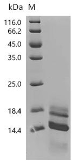 Recombinant Human Seizure protein 6 homolog (SEZ6), partial (CSB-MP684467HU10)