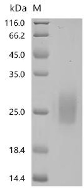 Recombinant Human Seizure protein 6 homolog (SEZ6), partial (CSB-MP684467HU6)