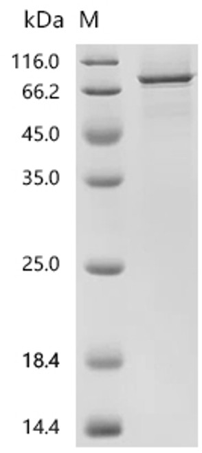 Recombinant Human Long-chain-fatty-acid--CoA ligase 1 (ACSL1)-Detergent (CSB-MP001191HU-D) Recombinant Human Long-chain-fatty-acid--CoA ligase 1 (ACSL1)-Detergent (CSB-MP001191HU-D)