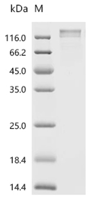 Recombinant Human Seizure protein 6 homolog (SEZ6), partial (CSB-MP684467HU3p2) Recombinant Human Seizure protein 6 homolog (SEZ6), partial (CSB-MP684467HU3p2)