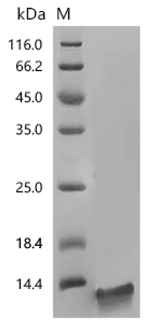 Recombinant Human Chromogranin-A (CHGA) (CSB-YP005344HUd7) Recombinant Human Chromogranin-A (CHGA) (CSB-YP005344HUd7)